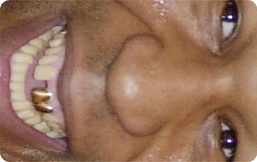 Tyson Grillz